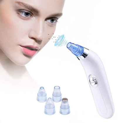 Limpiador de Poros Facial mediante Succión